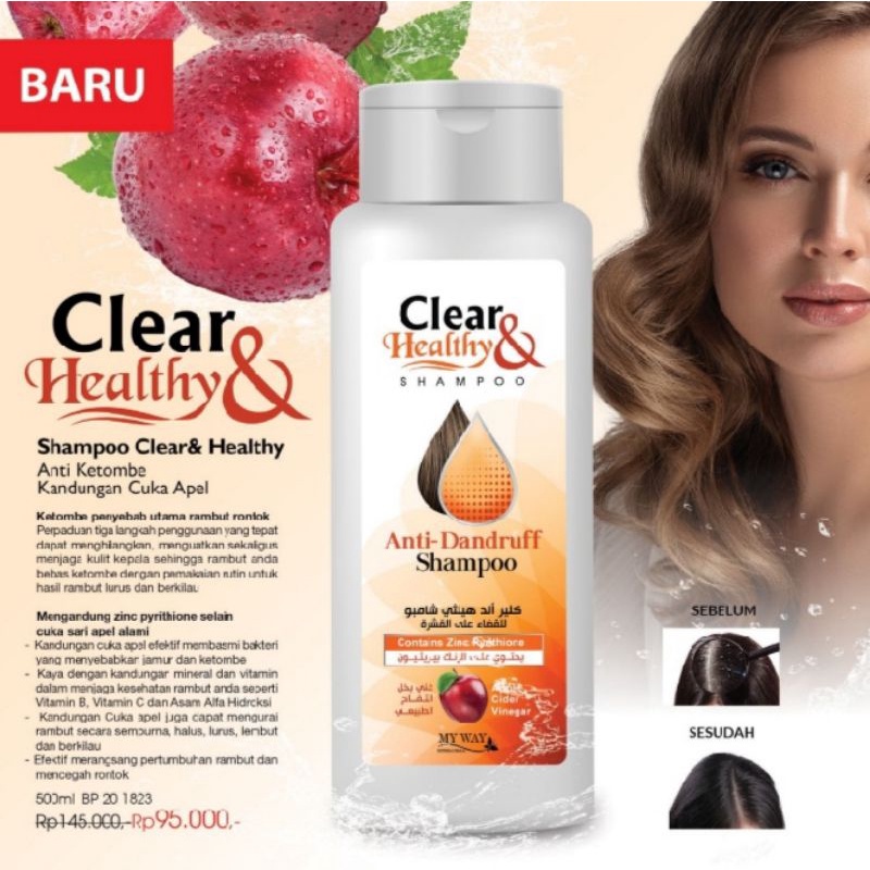 Shampo anti dendruf/anti ketombe MY WAY