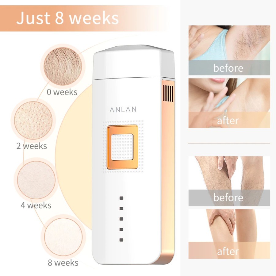 ANLAN TMY02 IPL Laser Epilator Hair Removal 500000Flashes ALTMY02-EU02 - White