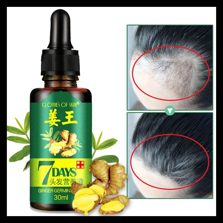7 Days Ginger Germinal Oil Mask Minyak Rambut Kering Oil Serum Gel Penumbuh Rambut Botak Kering