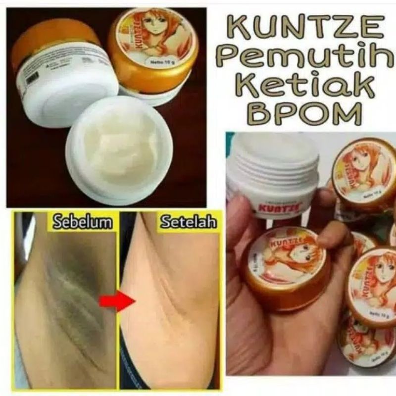 cream ketiak kuntze original bpom/pemutih ketiak selangkangan leher/pemutih kulit/shinkurim termurah