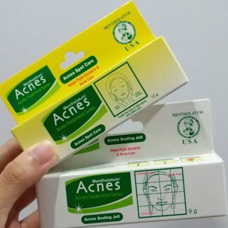 cream Acnes jel