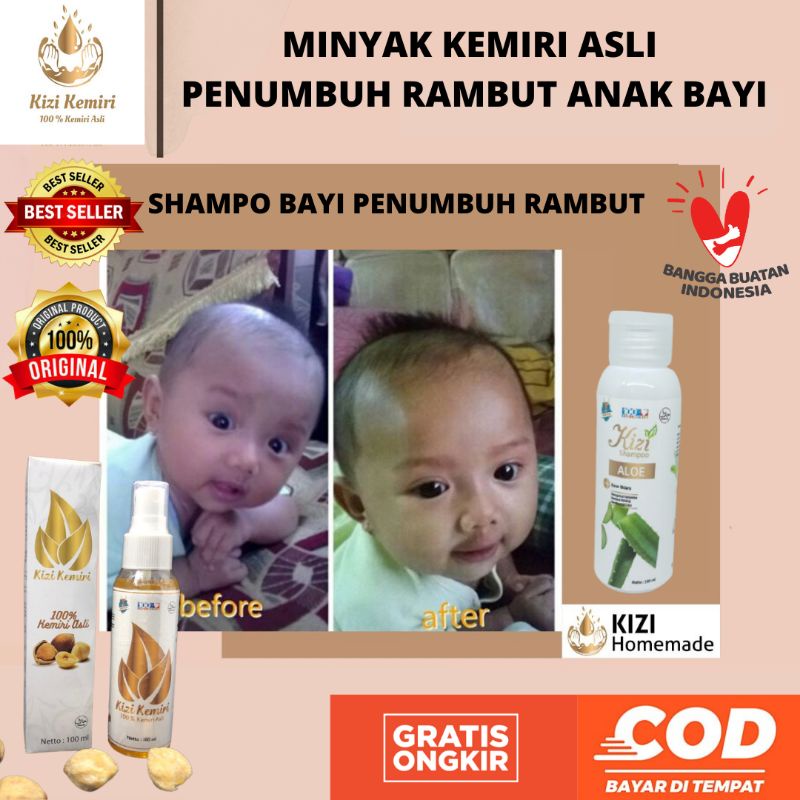 MINYAK KEMIRI PENUMBUH RAMBUT, MINYAK RAMBUT BAYI, PERAWATAN RAMBUT BAYI, VITAMIN PELEBAT RAMBUT, PE