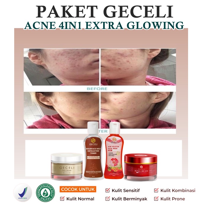 PAKET GECELI ACNE ISI 4 BISA COD - Paket Red Jelly Extra Glowing - Geceli Extra Glowing 1 Paket - Cr