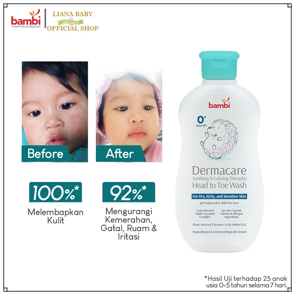 PERA689 BAMBI DERMACARE DAILY SOOTHING AND CALMING THERAPY HEAD TOE WASH SABUN&amp;SHAMPO BAYI KULIT SENSITIF