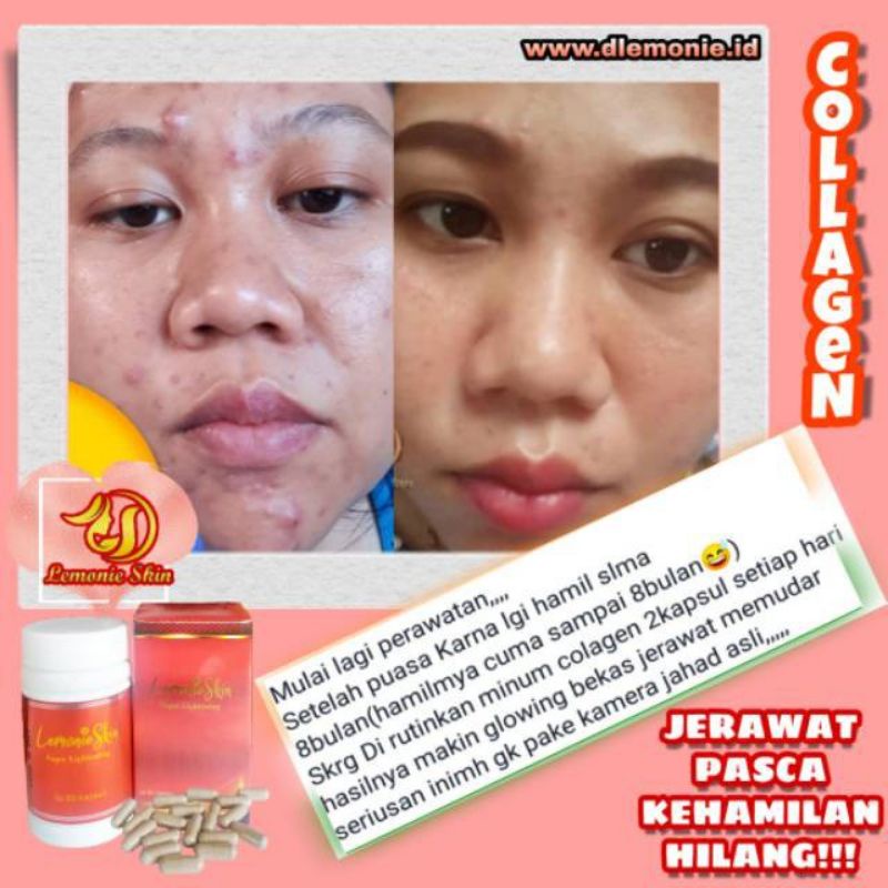 LEMONIESKIN COLLAGEN SUPER LIGHTENING Kolagen Herbal Perawatan Kulit & Kecantikan by d'Lemonie
