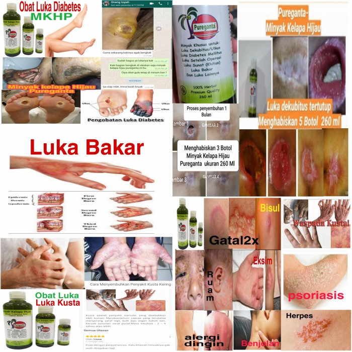 

R45Dgf5 Pureganta 300 Ml ( Minyak Kelapa Hijau Tradisional Karo ) - 260 Ml 6Dyhr57