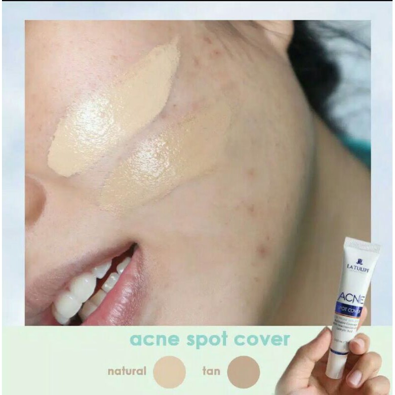 latulipe acne spot cover