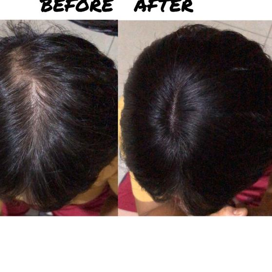 HARGA GROSIR >> Skin Toupee human Hair / Tempelan penutup botak rambut asli rambut palsu wig wanita 