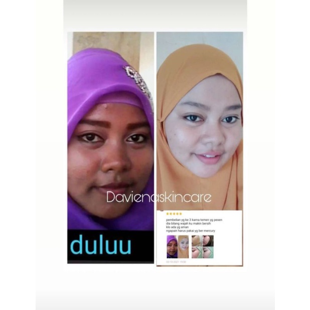 Daviena Skincare Paket Gold Series Davienaskincareofficial Davina Devina Lampung Surabaya Jakarta Pencerah Pemutih Flek Wajah Glowing Bpom Daviena Skincare-4