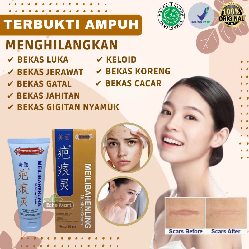 Salep Obat Cream Meilibahenling Penghilang Bekas Luka Lama Hitam Koreng Jerawat Bopeng Melibahenling