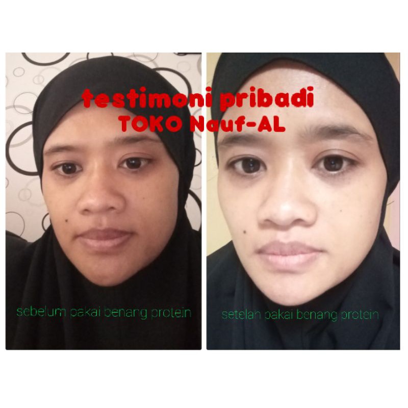 [ORIGINAL] VENZEN GOLD PROTEIN LINE PEPTIDE Tanam Benang Tanpa Jarum Serum Perawatan kecantikan gold-4