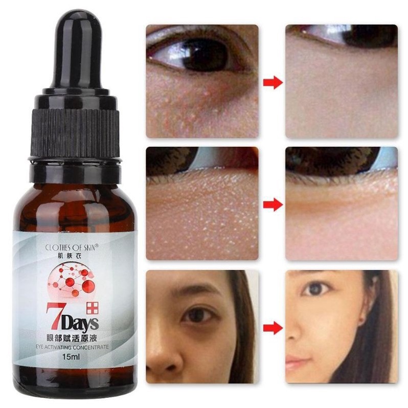 Obat Milia Obat Milia di Bawah Mata Obat Milia Pada Wajah - Penghilang Milia Mata Serum Milia 7days 