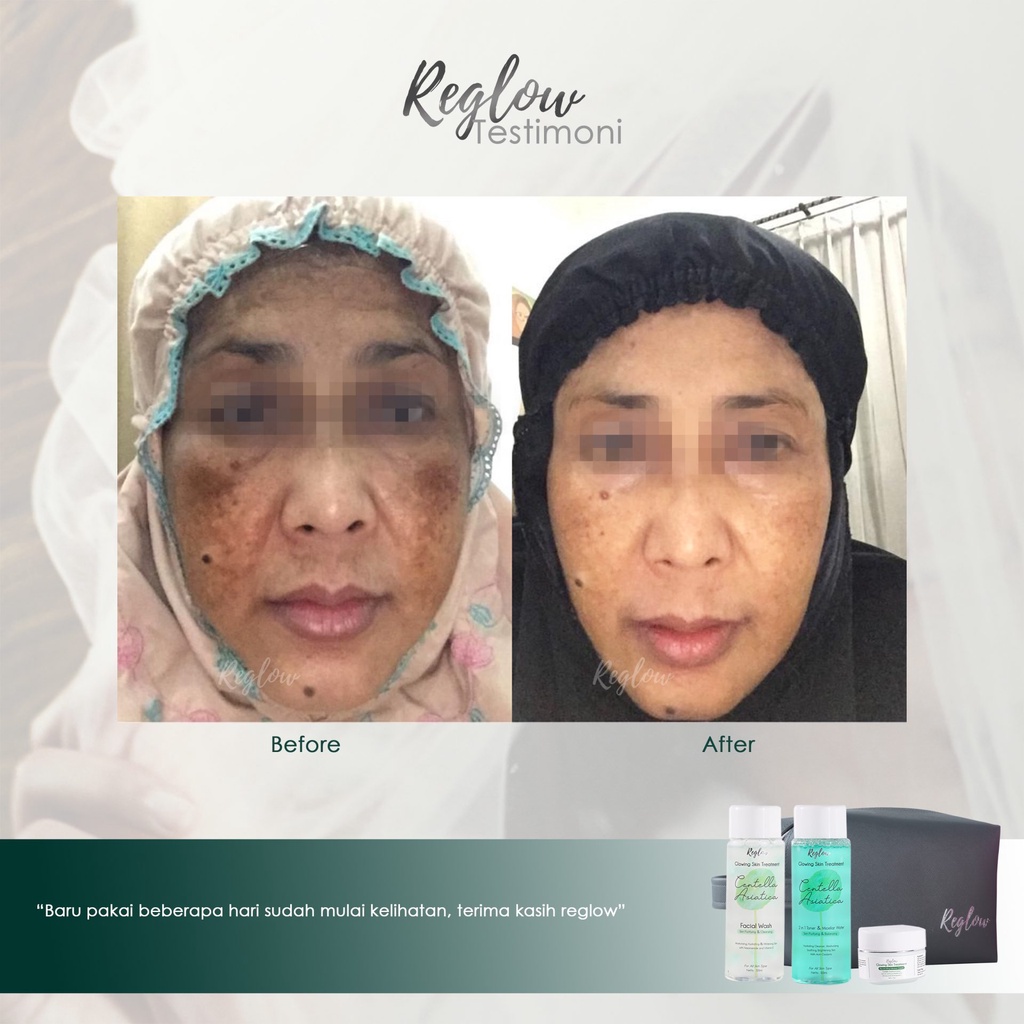 REGLOW SERIES Glowing skin Treatment Original BPOM - RE GLOW-1
