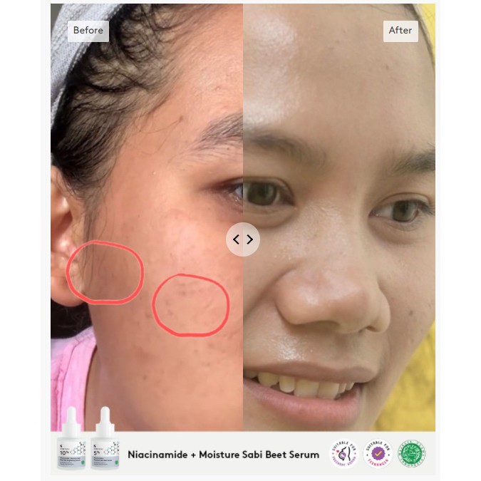 [BPOM] Somethinc Niacinamide + Moisture Sabi Beet Serum [5% | 10%]