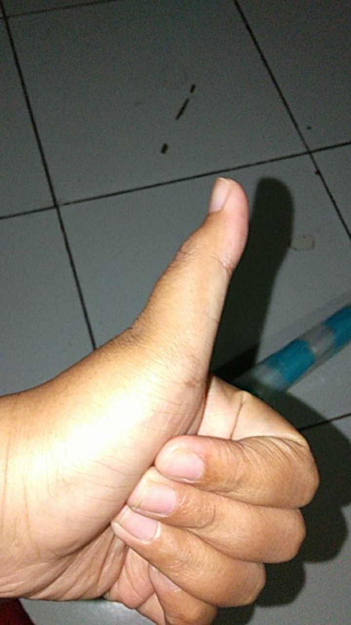 Tabasa Payung Tongkat Stripes Ilusi Simple Garis Garis