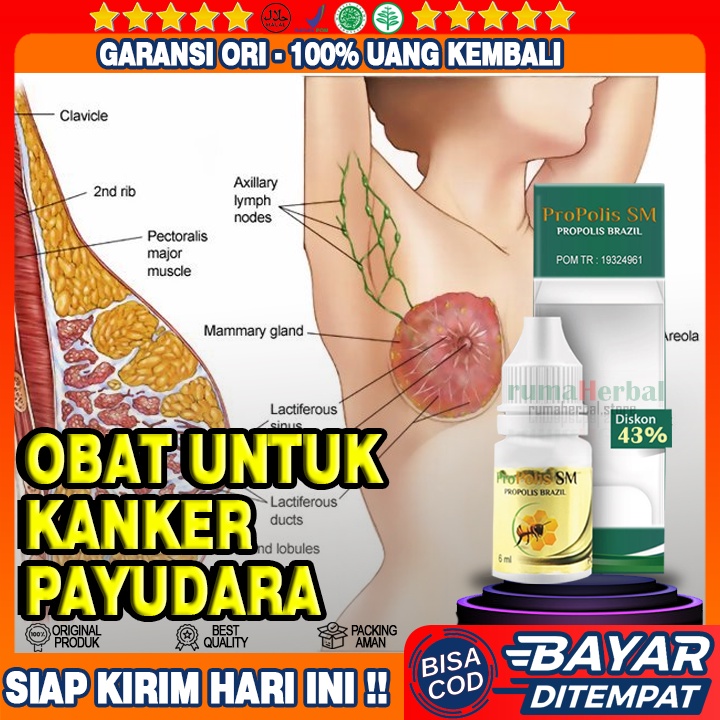 Obat Kanker Payudara, Benjolan Payudara, Tumor Payudara, Kista Payudara, Puting Payudara Lecet