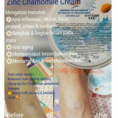 zinc chamomile cream