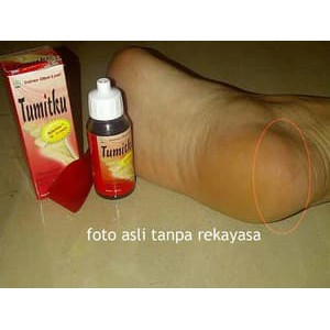 TUMITKU Obat Kaki Kapalan Kering Pecah Pecah