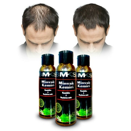 [ORI] BMKS Minyak Kemiri Penumbuh Rambut Original 100% Asli Kemiri Obat Penumbuh Rambut Aman Untuk Bayi 100ml