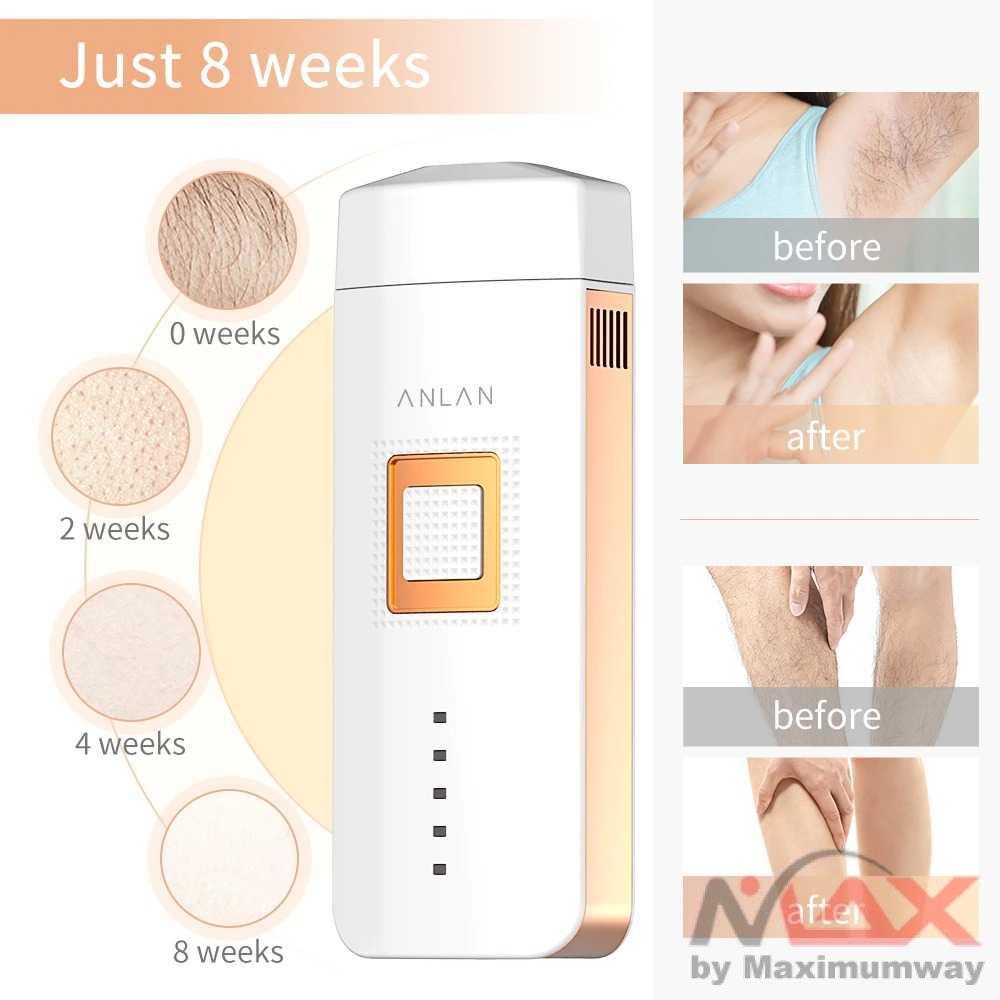 ANLAN TMY02 Laser Penghilang Bulu PERMANEN IPL Handheld Laser Epilator Depilador Facial Permanent Hair Removal Device Whole Body Laser Hair Remover Machine Advanced Electric Hair Removal For Women Face Body &amp; Bikini Trimmer KIT