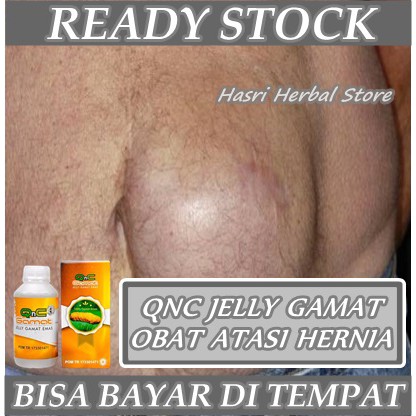 Obat Hernia - Hernia Nukleus - Turun Berok - Usus Turun Pria &amp; Wanita I QnC Jelly Gamat