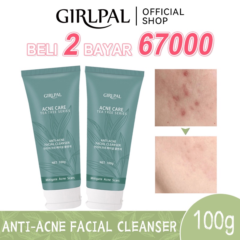 GIRLPAL Anti Acne Facial Cleanser 100g Tea Tree Acne Treatment Foam Pembersih Wajah Jerawat Wash