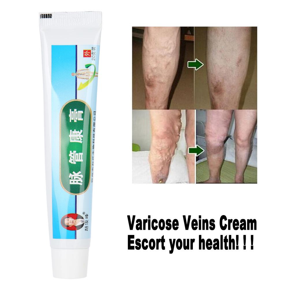 varicobuster medicine din varicoza