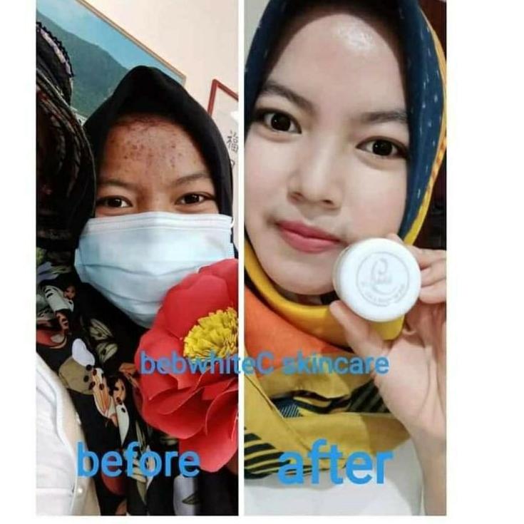 ✭ [PROMO] CREAM SKINCARE BEBWHITE C ORIGINAL ORI /BB WHITE C /BBC ACNE GLOW ♙