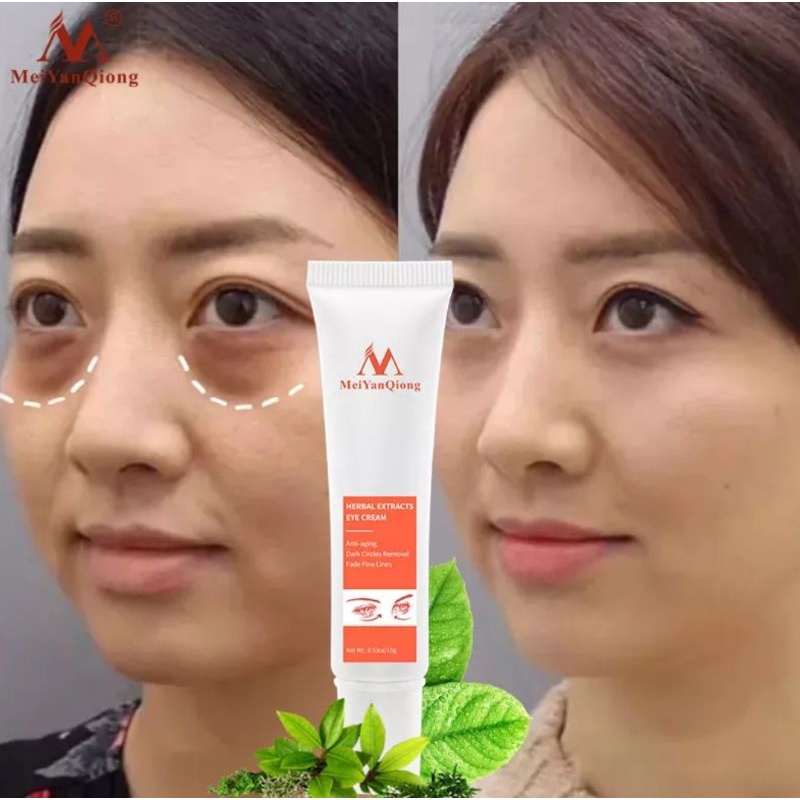 MeiYanQiong Herbal Probiotic Eye Cream Mengurangi Dark Circle-Anti Wrinkle-Anti Aging-Mengurangi Lingkaran Mata Hitam-15gr