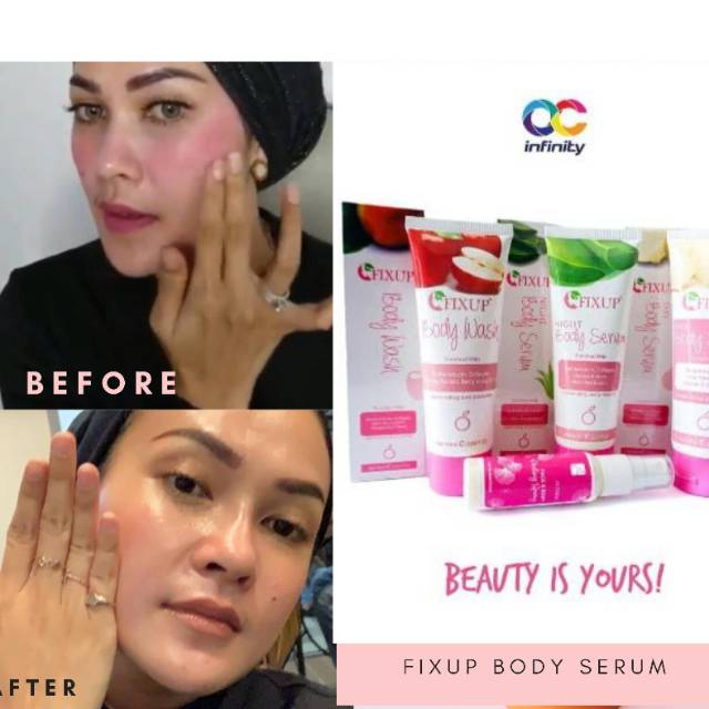 1 Paket BODY LOTION PEMUTIH KULIT FIXUP BODY SERUM