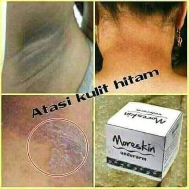 Moreskin Underarm