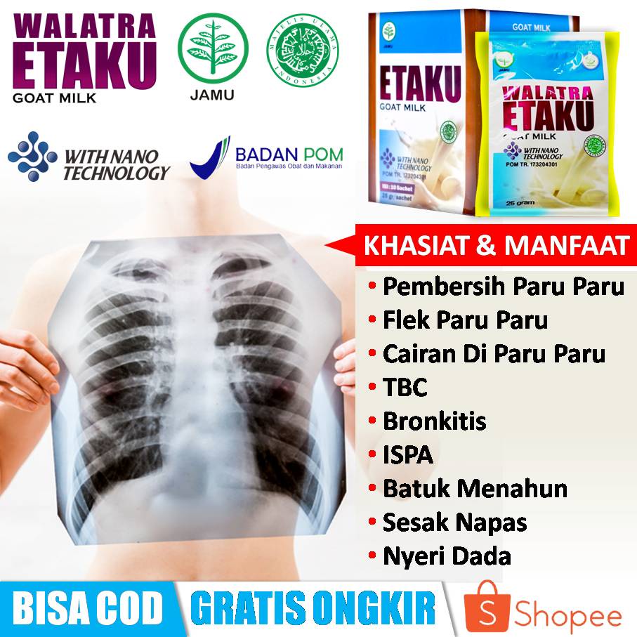 

Obat Flek Paru Paru, Pembersih Paru Paru Kotor, Penghilang Cairan Di Paru Paru, Radang Paru Paru, Pneumonia, TBC, Bronkitis, Batuk Menahun, Sesak Napas, ISPA, ASMA, Nyeri Dada, Asam Lambung, Maag Kronis, Infeksi Ginjal, Usus Buntu - Walatra Etaku Original
