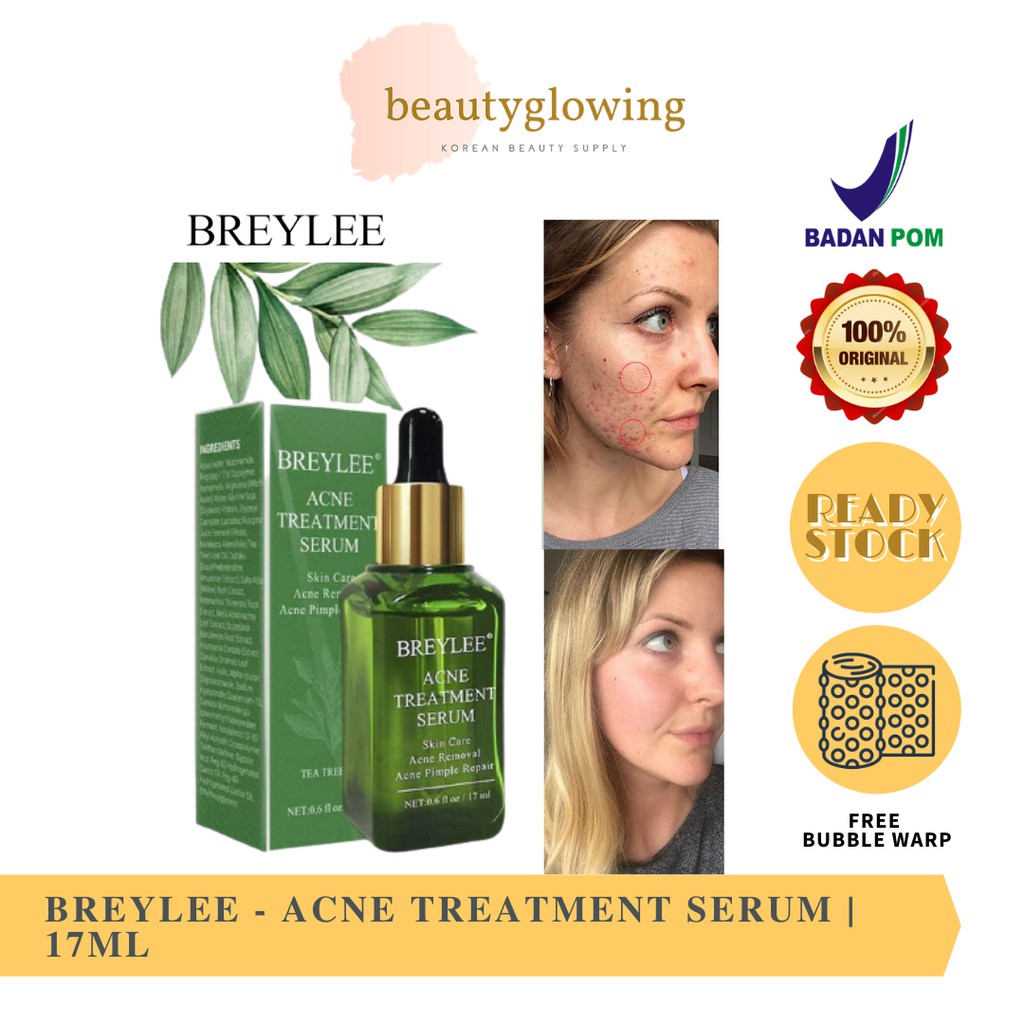 BREYLEE  Acne Treatment Serum - Wajah Berjerawat (17ml)