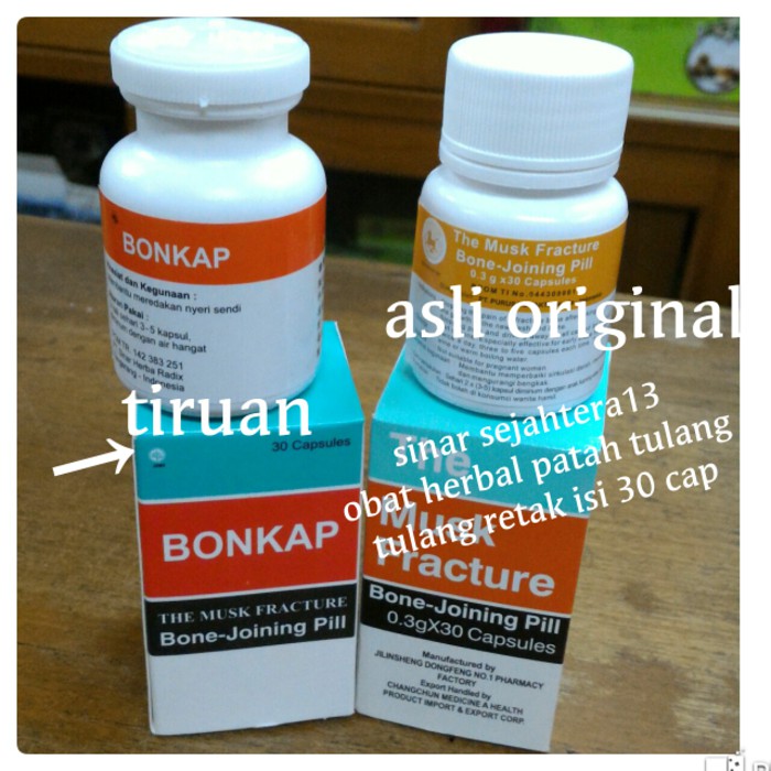 Jual Obat Patah Tulang Dan Tulang Retak Obat Penyembuhan Pada Tulang Retak Murah Shopee Indonesia