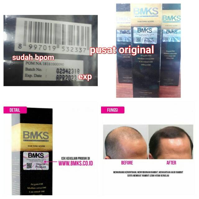 BMKS HAIR TONIC KEMIRI ORIGINAL MENUMBUHKAN DAN MENYUBURKAN RAMBUT