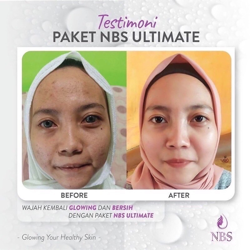 BEST SELLER !! PAKET LENGKAP NBS SKINCARE ULTIMATE