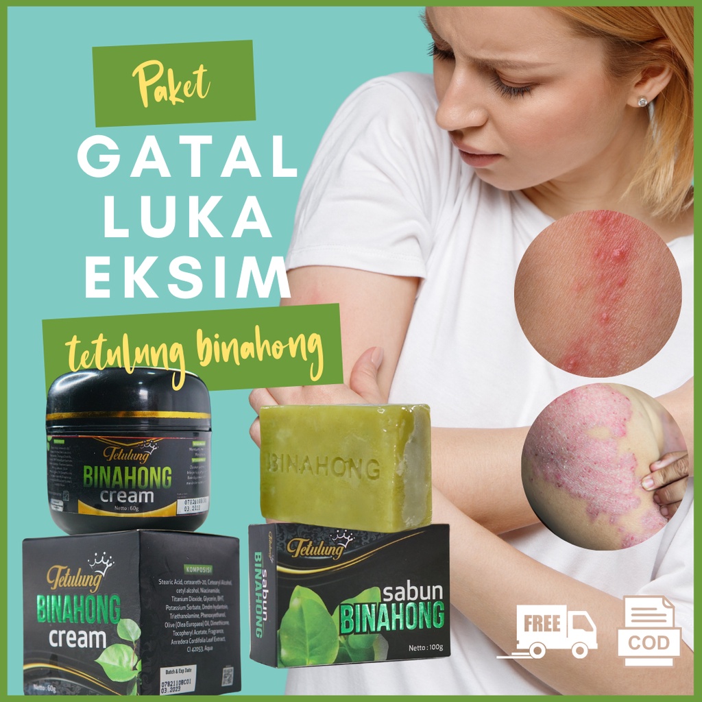 PAKET HEMAT TETULUNG BINAHONG, CREAM BINAHONG 60gr & SABUN BINAHONG, OBAT LUKA dan GATAL, Obat Gatal