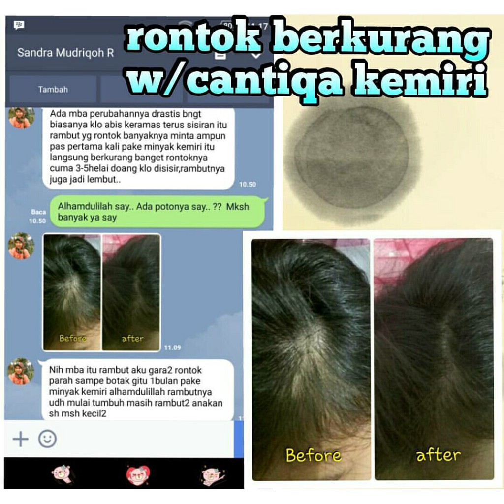 PAKET CANTIQA KEMIRI Penumbuh Rambut Botak Pitak Nonong Herbal Alami