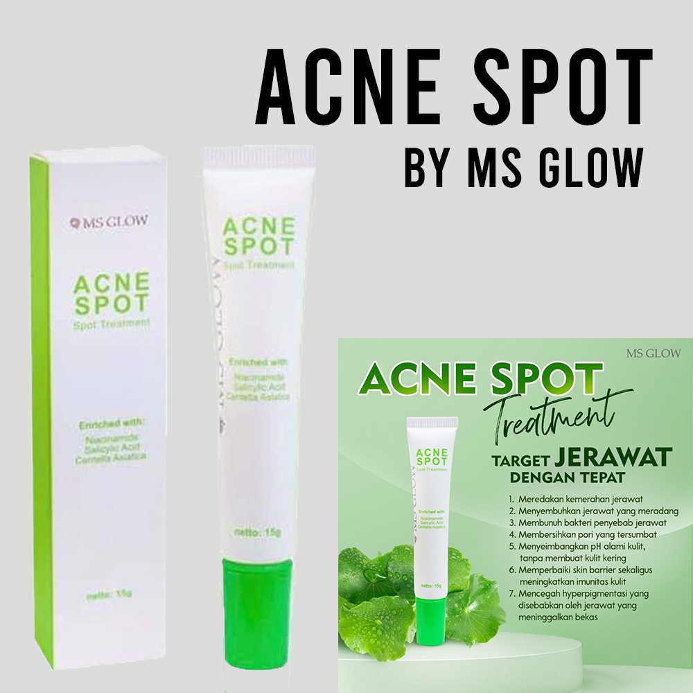 Acne Spot Ms Glow Obat Totol Jerawat Acne treatment Ms glow Original