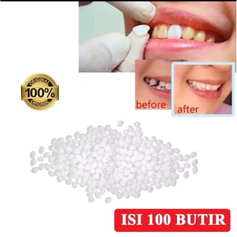PENAMBAL GIGI BERLUBANG 100 BUTIR / TEMPTOOTH / GIGI PALSU / LEM GIGI PADAT / LEM GIGI BERLUBANG