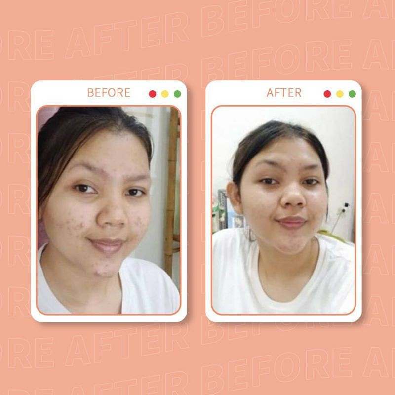 Vavl Beaute 1 Paket Package (Free pouch & gift)-7