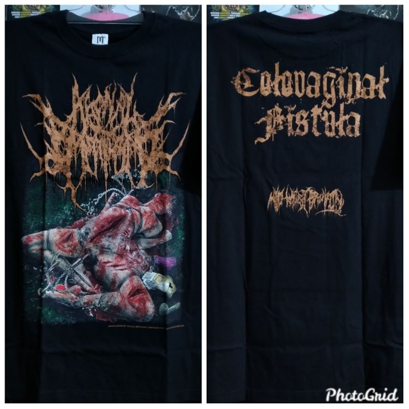 Ts agonal breathing - colovaginal