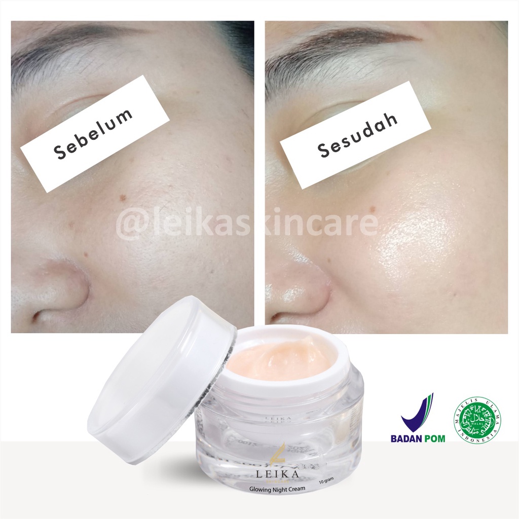 Ampuh! Pelembab Wajah Bikin Kulit Wajah Glowing dan Putih Krim Pelembab Wajah Kering Berjerawat Ampuh Glowing Night Cream Leika Skincare Cream Wajah Glowing Aman BPOM Krim Pe mutih Wajah bpom Glowing Cream Pe mutih Wajah Glowing  BPOM Asli 100% HALAL MUI