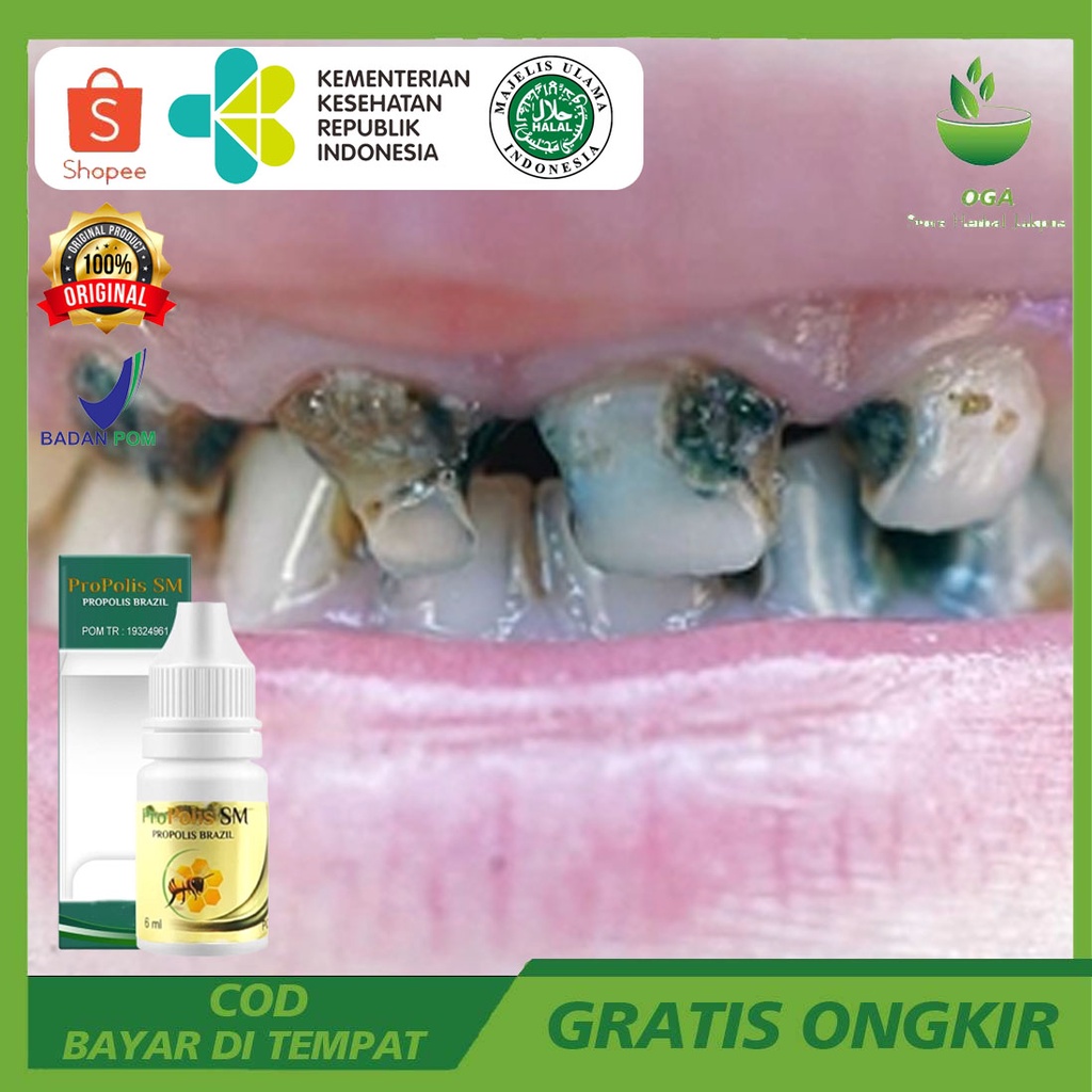 Obat Untuk Membunuh Ulat Gigi, Obat Kumur Ulat Gigi, Pembasmi Ulat Gigi Cepat, Mengeluarkan Ulat Gig