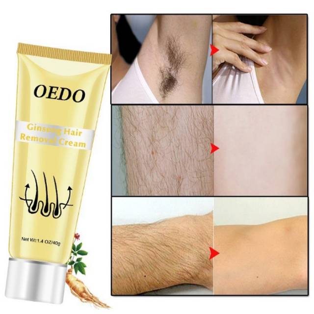 Oedo Cream Penghilang Bulu Untuk Pria Wanita