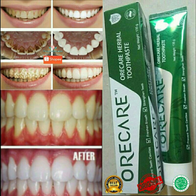 (COD)odol tiens/odol tianshi/orecare tiens/orecare tianshi/super whitening/orecare/pasta gigi terbai