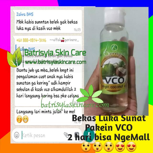 Virgin Coconut Oil Vco Minyak Sejuta Manfaat Minyak Sehat Shopee Indonesia