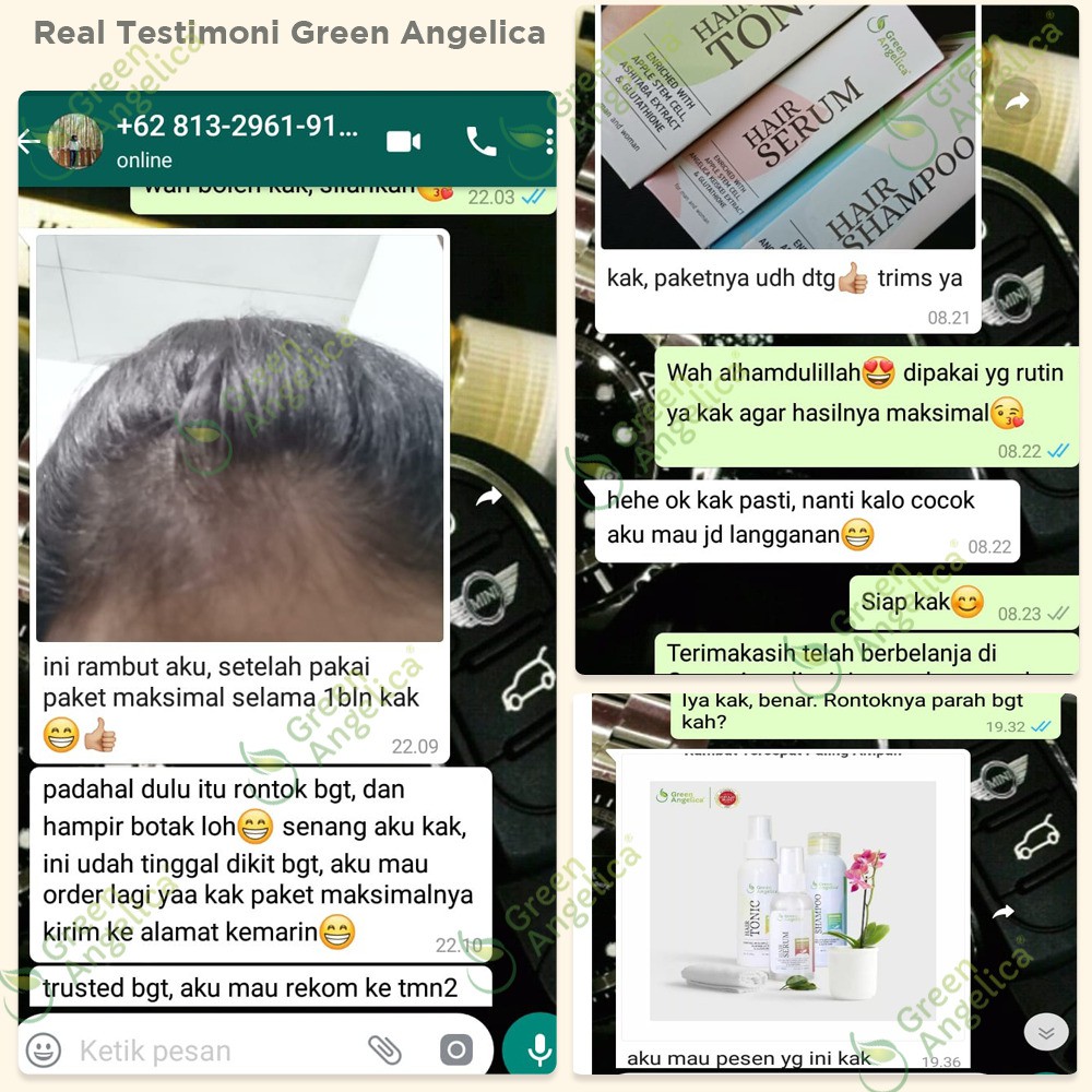 Perawatan Rambut Agar Tidak Botak Paket Lengkap Green Angelica Terampuh