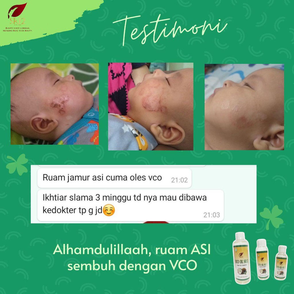 VCO SR12 Virgin Coconut Oil Minyak Kelapa Murni Untuk Bayi Rambut Diet Imun Asi Booster Antioksidan Anti Aging Kecantikan Dan Kesehatan