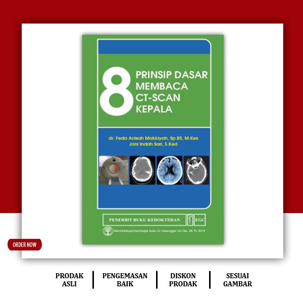 

8 Prinsip Dasar Membaca CT-Scan Kepala